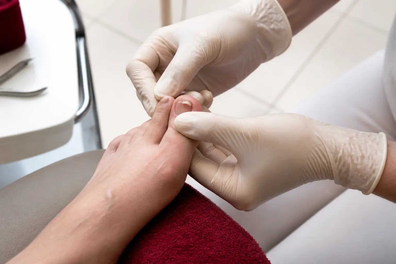 Onychoplastie en cabinet podologique : podiatre examinant un ongle d’orteil abîmé sur un pied posé sur une chaise de soin.